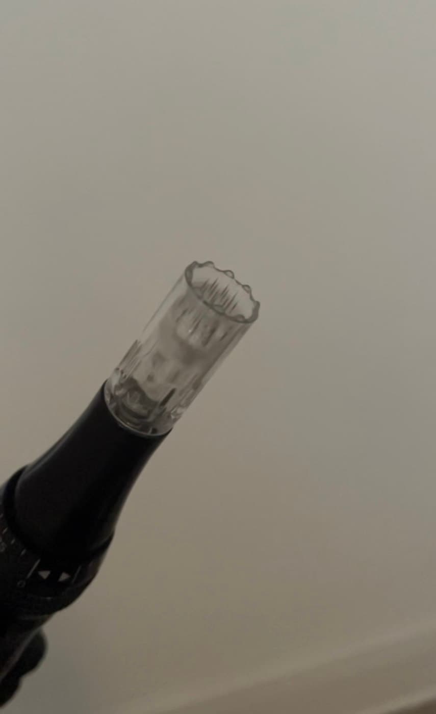 Close-up of a microneedling pen cartridge used during a skin treatment at Fresh Faced Skin Clinic in Grimsby.