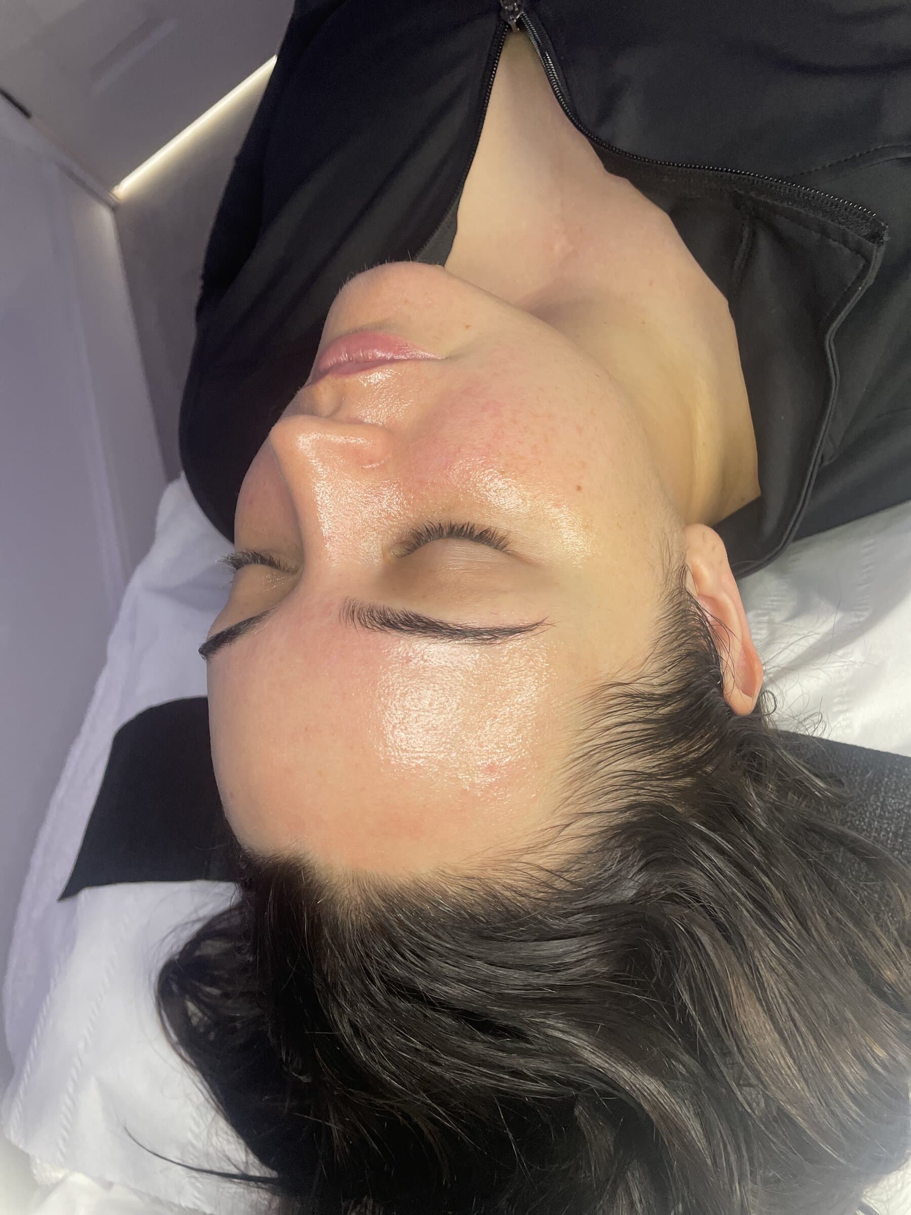 Close-up of clear, even, hydrated skin after treatment at Fresh Faced Skin Clinic in Grimsby.